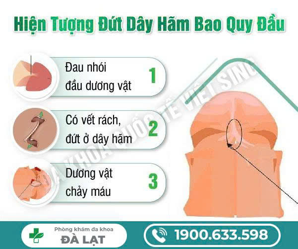 Hình ảnh minh họa